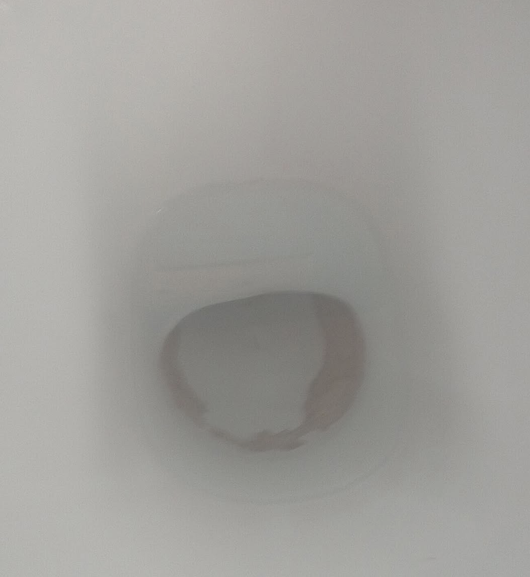 e volevo un consiglio se si può efficace x togliere questo dentro il water (non causato da me) consigli? grazie mille ... X 1 72 Q 278 ~ 5